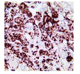 CA 19-9 Clone 121SLE Pronto Para Uso - 6 Ml - Easypath - EP-12-50266